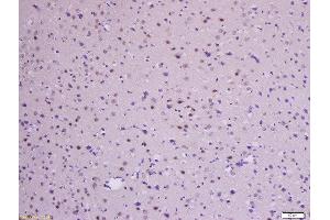 Formalin-fixed and paraffin embedded rat brain labeled with Anti-Beta-Catenin (Ser33 + 37) Polyclonal Antibody, Unconjugated  at 1:200 followed by conjugation to the secondary antibody and DAB staining.