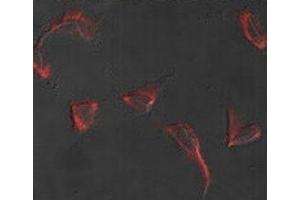 Immunofluorescence analysis of Nestin antibody and HeLa cells.