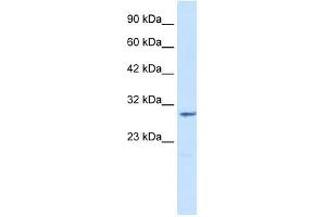 CLIC2 antibody used at 1. (CLIC2 anticorps  (Middle Region))