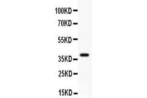 Anti- GAD67 Picoband antibody, Western blottingAll lanes: Anti GAD67  at 0. (GAD anticorps  (AA 14-122))
