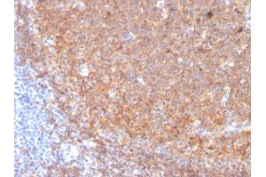 Formalin-fixed, paraffin-embedded human Tonsil stained with CD19 Monospecific Mouse Monoclonal Antibody (CD19/3117).