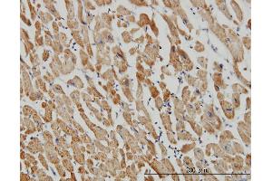 Immunoperoxidase of monoclonal antibody to ACOT9 on formalin-fixed paraffin-embedded human heart.