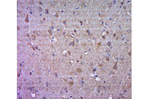 Paraformaldehyde-fixed, paraffin embedded mouse brain tissue, Antigen retrieval by boiling in sodium citrate buffer (pH6.
