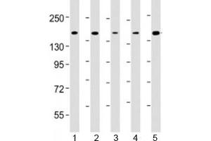 Western blot testing of human 1) K562, 2) Jurkat, 3) HeLa, 4) rat C6 and 5) human MOLT-4 cell lysate with CTCF antibody at 1:4000. (CTCF anticorps  (AA 445-727))