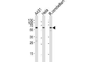 Western blot analysis of lysates from A431, Hela cell line and rat cerebellum tissue lysare(from left to right), using KISS1R Antibody (Center) (ABIN1881480 and ABIN2843217). (KISS1R anticorps  (AA 235-263))