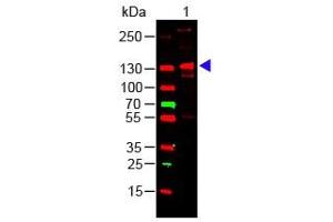 Lane 1: Human Collagen III. (COL3 anticorps)