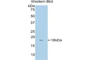 Western blot analysis of the recombinant protein. (CYP1B1 anticorps  (AA 374-516))