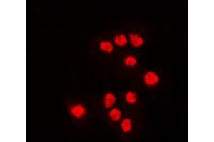 Immunofluorescent analysis of ATF7 staining in Jurkat cells. (AFT7 anticorps  (Center))