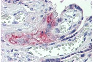 Human Placenta: Formalin-Fixed, Paraffin-Embedded (FFPE) (F2RL2 anticorps  (Internal Region))
