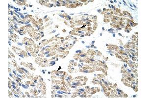 HNRPK antibody was used for immunohistochemistry at a concentration of 4-8 ug/ml to stain Skeletal muscle cells (arrows) in Human Muscle.