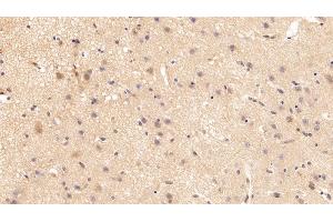 Detection of GSN in Porcine Cerebrum Tissue using Polyclonal Antibody to Gelsolin (GSN)