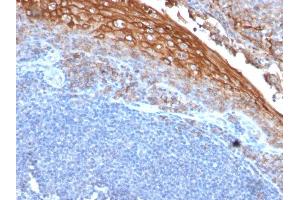 Formalin-fixed, paraffin-embedded human Tonsil stained with MUC18 Mouse Recombinant Monoclonal Antibody (rMUC18/1130). (Recombinant MCAM anticorps)