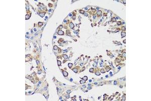 Immunohistochemistry of paraffin-embedded mouse testis using Cyclin B1 antibody (ABIN7266555) at dilution of 1:100 (40x lens).