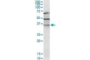 NMNAT2 monoclonal antibody (M02), clone 4E6. (NMNAT2 anticorps  (AA 208-307))