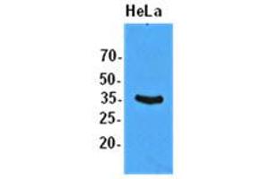Western Blotting (WB) image for anti-Eukaryotic Translation Initiation Factor 2 Subunit 1 (EIF2S1) antibody (ABIN781543) (EIF2S1 anticorps)