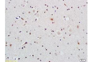 Formalin-fixed and paraffin embedded rat brain tissue labeled with Anti-ERCC1 Polyclonal Antibody, Unconjugated  at 1:200 followed by conjugation to the secondary antibody and DAB staining