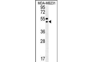 TR Antibody (C-term) (ABIN652176 and ABIN2840578) western blot analysis in MDA-M cell line lysates (35 μg/lane). (TRAM2 anticorps  (C-Term))