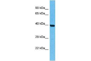 Western Blotting (WB) image for anti-Olfactory Receptor, Family 5, Subfamily T, Member 2 (OR5T2) (C-Term) antibody (ABIN2774565) (OR5T2 anticorps  (C-Term))