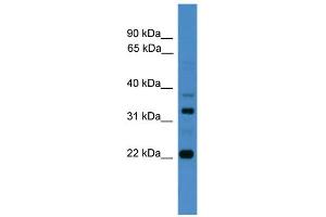 WB Suggested Anti-AMZ2 Antibody Titration: 0. (AMZ2 anticorps  (C-Term))