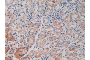 IHC-P analysis of Human Stomach Tissue, with DAB staining. (DDX58 anticorps  (AA 550-776))