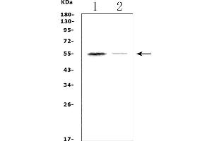 Western blot analysis of CHRM1 using anti-CHRM1 antibody (ABIN7602749).