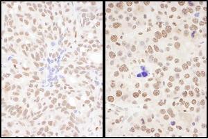anti-Splicing Factor, Arginine/Serine Rich 7 (SFRS7) (AA 188-238) antibody