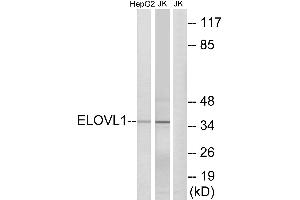 Western blot analysis of extracts from HepG2 cells and Jurkat cells, using ELOVL1 antibody.