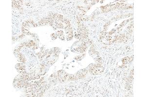 Immunohistochemistry (IHC) image for anti-RNA Polymerase II (pSer2) antibody (ABIN7454655) (RNA Polymerase II anticorps  (pSer2))
