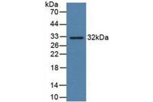 WB of Protein Standard: different control antibodies against Highly purified E. (PD-L1 Kit ELISA)
