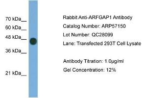 WB Suggested Anti-ARFGAP1  Antibody Titration: 0. (ARFGAP1 anticorps  (Middle Region))
