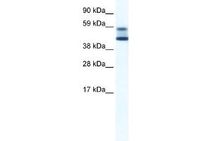 WB Suggested Anti-ZBTB7A Antibody Titration:  5. (ZBTB7A anticorps  (N-Term))
