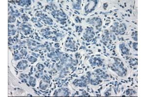 Immunohistochemical staining of paraffin-embedded breast tissue using anti-FCGR2A mouse monoclonal antibody. (FCGR2A anticorps)