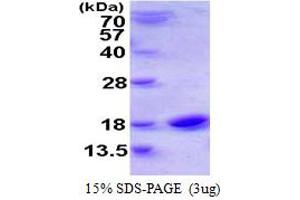 SDS-PAGE (SDS) image for Cystatin SN (CST1) (AA 21-141) protein (His tag) (ABIN667631)