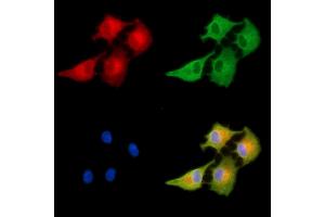 ABIN6263078 and ABIN6278934 staining  cells by IF/ICC. (MAGEF1 anticorps  (Internal Region))