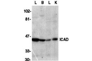 Western Blotting (WB) image for anti-DNA Fragmentation Factor, 45kDa, alpha Polypeptide (DFFA) (C-Term) antibody (ABIN1030428) (DFFA anticorps  (C-Term))