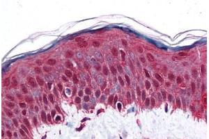 Human Skin: Formalin-Fixed, Paraffin-Embedded (FFPE) (Retinoblastoma Binding Protein 8 anticorps  (AA 452-747))