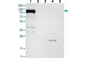Western blot analysis of Lane 1: RT-4, Lane 2: U-251 MG, Lane 3: Human Plasma, Lane 4: Liver, Lane 5: Tonsil with DHX36 polyclonal antibody  at 1:250-1:500 dilution. (DHX36 anticorps)