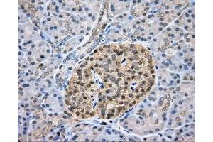 Immunohistochemical staining of paraffin-embedded liver tissue using anti-CAPZA1 mouse monoclonal antibody. (CAPZA1 anticorps)