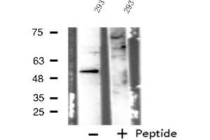 Western blot analysis of extracts from 293 cells, using IP6K3 antibody. (IP6K3 anticorps  (Internal Region))