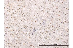 anti-Tetra-Peptide Repeat Homeobox 1 (TPRX1) (AA 313-411) antibody