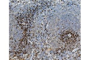 IHC analysis of CD8 alpha/Cd8a using anti-CD8 alpha/Cd8a antibody (ABIN7601570).