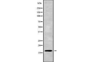 Western blot analysis of CST5 using NIH-3T3 whole cell lysates (CST5 anticorps  (Internal Region))