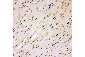 Anti- MSK1 Picoband antibody, IHC(P) IHC(P): Mouse Cardiac Muscle Tissue (MSK1 anticorps  (AA 540-665))