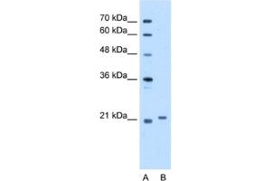 Western Blotting (WB) image for anti-Titin-Cap (Telethonin) (TCAP) antibody (ABIN2463159) (TCAP anticorps)