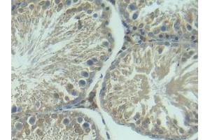 Detection of IGFBP3 in Rat Testis Tissue using Polyclonal Antibody to Insulin Like Growth Factor Binding Protein 3 (IGFBP3)