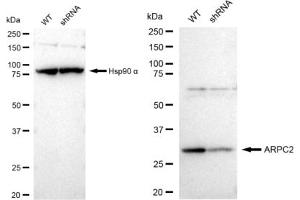 Western blotting analysis using ARPC2 antibody (ABIN7797453).