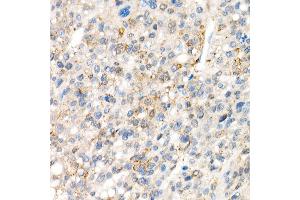Immunohistochemistry of paraffin-embedded Human liver (negative control sample) using Y antibody (ABIN7271418) at dilution of 1:1000 (40x lens).
