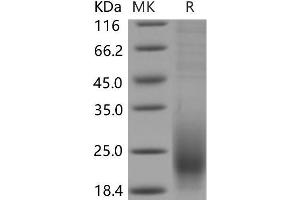 Western Blotting (WB) image for CD53 (CD53) (AA 107-181) protein (His tag) (ABIN7320175)