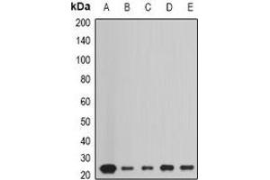Western blot analysis of Peroxiredoxin 1 expression in HepG2 (A), Hela (B), A549 (C), mouse liver (D), mouse heart (E) whole cell lysates. (Peroxiredoxin 1 anticorps)