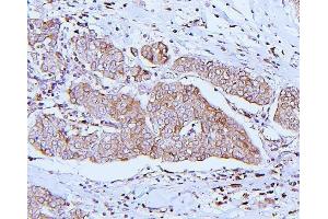 IHC analysis of ApoER2/LRP8 using anti-ApoER2/LRP8 antibody (ABIN7601752).